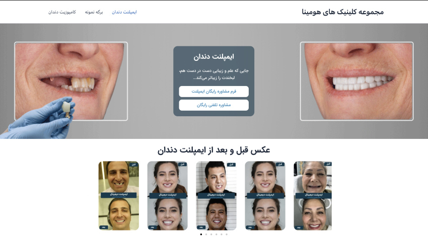 طراحی لندینگ سایت کلینیک هومینا